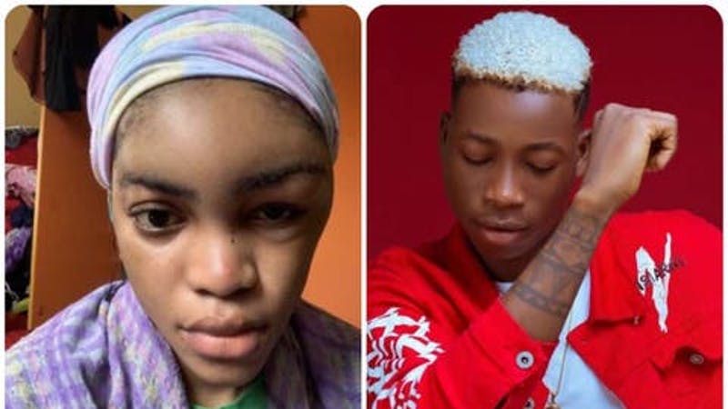Davido’s Former Signee, Lil Frosh Denies Beating Up His Girlfriend, Gift